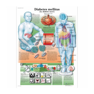 Planche anatomique “Diabète”