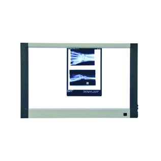 Négatoscope extra plat à Led Holtex